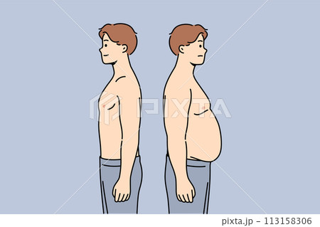 Thin and fat men stand side by side demonstrating changes in figures after eating fast food 113158306