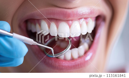 Close up of female mouth with dental mirror. Dentistry concept 113161841