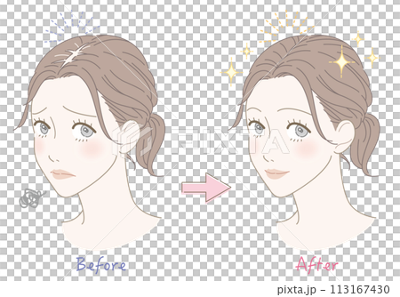 Thinning hair worries before and after woman illustration 113167430
