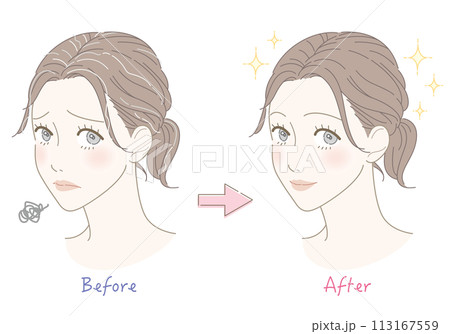 白髪　悩み　ビフォーアフター　女性　イラスト 113167559