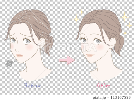 白髪　悩み　ビフォーアフター　女性　イラスト 113167559