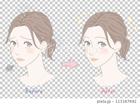 フケ　悩み　ビフォーアフター　女性　イラスト 113167692