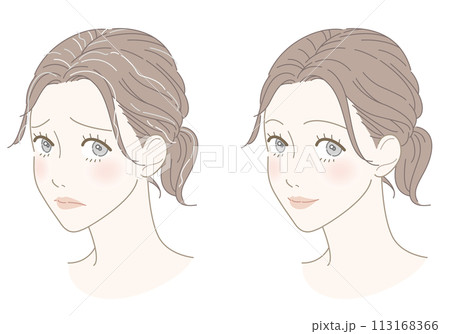 白髪 改善 女性 イラスト 白髪 改善 女性 イラスト 113168366