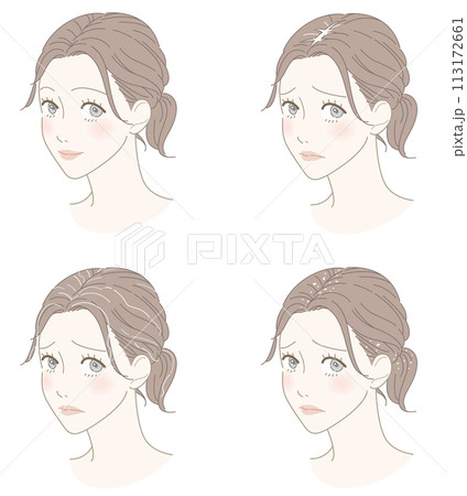 頭皮・髪のトラブルセット　名称なし 113172661