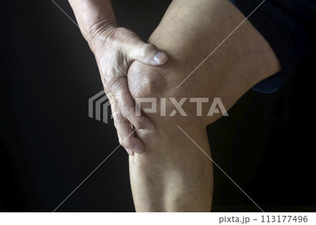 膝痛で苦しむ老人の膝 113177496