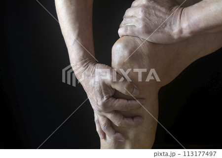 膝痛で苦しむ老人の膝 113177497
