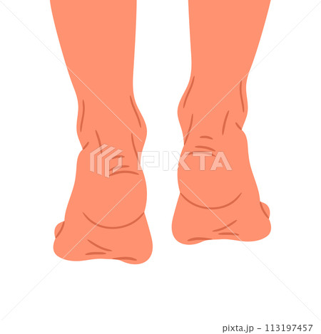 Barefoot legs back view. Woman walks or sneaks on tiptoes, female naked feet, bare pair of legs flat vector illustration. Hand drawn feet on white 113197457
