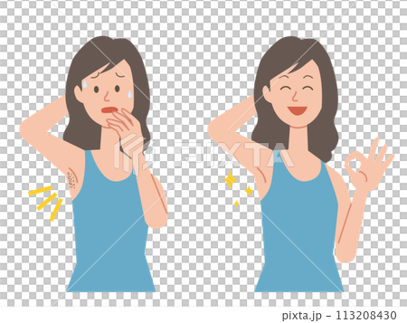 一名女性患有多餘頭髮的前後對比圖 一名女性患有多餘頭髮的前後對比圖 113208430