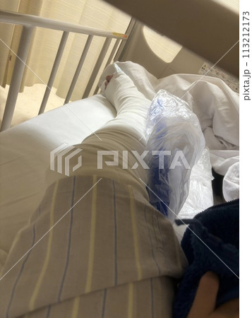 足骨折、入院中 113212173