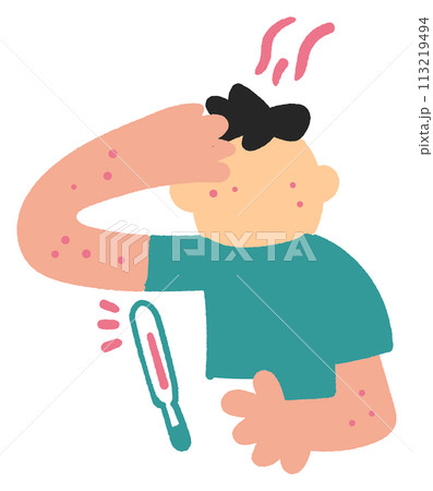 はしかの症状がある子供のイラスト素材 113219494