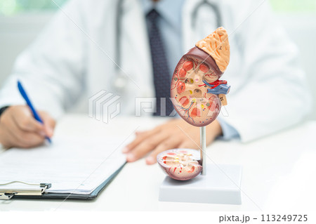 Kidney disease, Chronic kidney disease ckd, Doctor with human model to study and treat in hospital. Kidney disease, Chronic kidney disease ckd, Doctor with human model to study and treat in hospital. 113249725