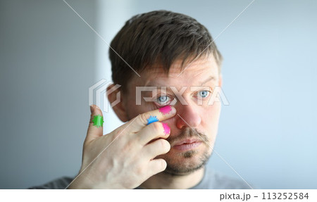 Man scratches his face with a dirty hand near his eye 113252584