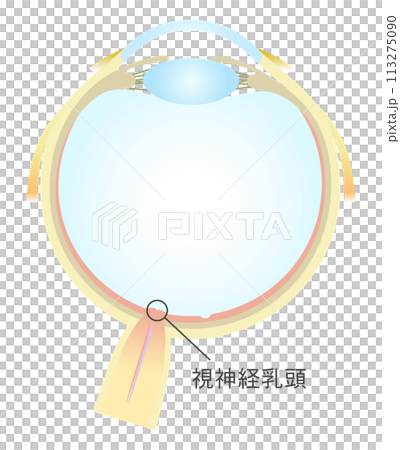 Horizontal section of the eye Optic disc 113275090