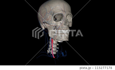 Right common carotid artery 113277178