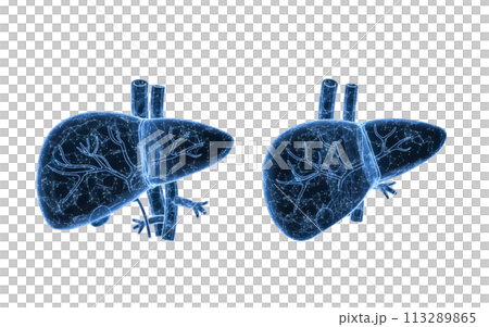 Liver organ with health care concept, 3d rendering. Liver organ with health care concept, 3d rendering. 113289865