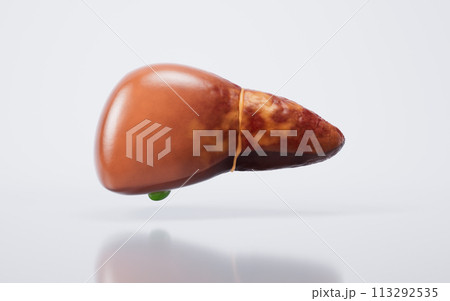 Liver organ with fatty liver state, 3d rendering. 113292535