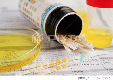 Urinalysis, urine cup with reagent strip pH paper test and comparison chart in laboratory. Urinalysis, urine cup with reagent strip pH paper test and comparison chart in laboratory. 113299797
