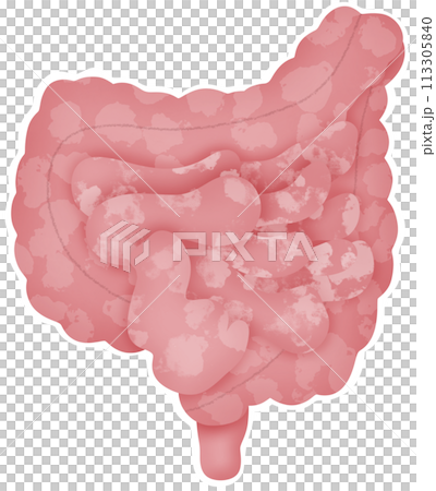 Intestine 113305840