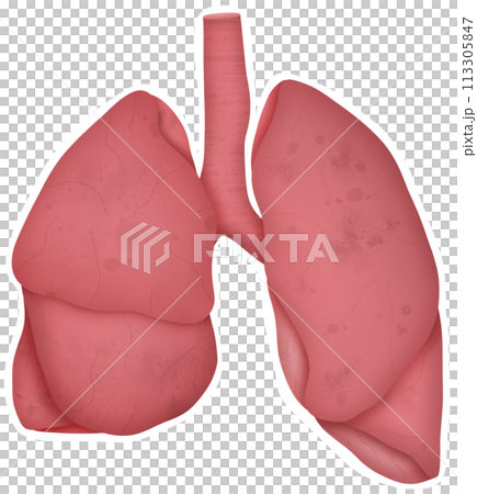 Lung 113305847