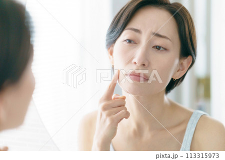 スキンケアに悩むミドル女性 113315973