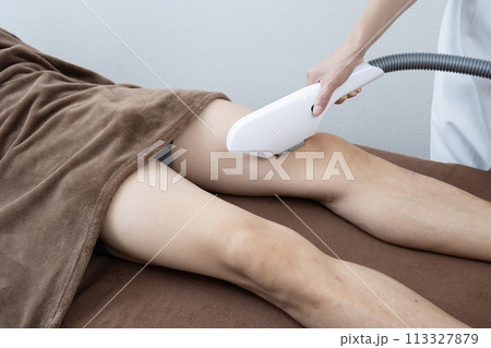 メンズ脱毛の施術を受ける男性 113327879