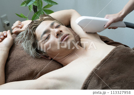 メンズ脱毛の施術を受ける男性 113327958