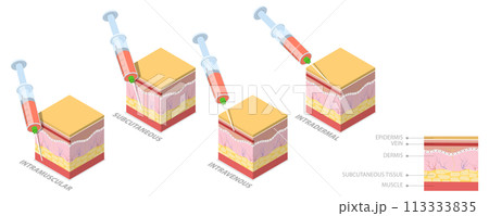 3D Isometric Flat  Conceptual Illustration of Injection Types 113333835