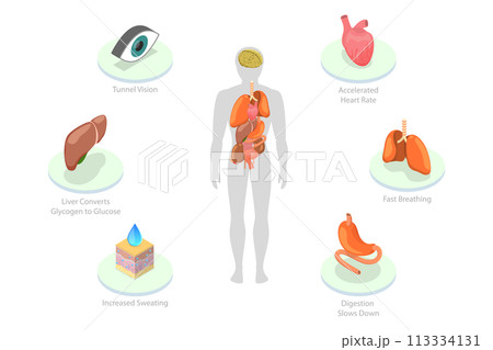 3D Isometric Flat  Conceptual Illustration of Stress Response 113334131