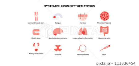 Systemic lupus erythematosus 113336454