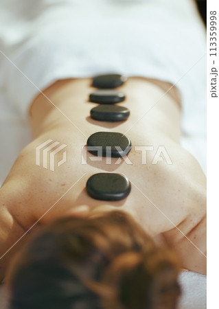 Woman having hot stone massage and laying on massage table 113359998