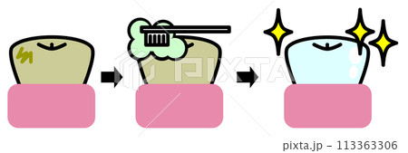 汚れた歯を歯医者で掃除して綺麗にホワイトニングされた歯のイラスト 汚れた歯を歯医者で掃除して綺麗にホワイトニングされた歯のイラスト 113363306