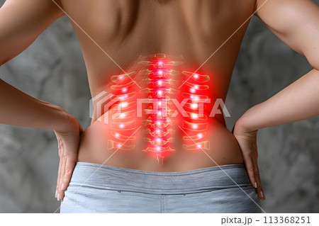 Womans Back Illuminated by Red Light. Back pain. Generative AI Womans Back Illuminated by Red Light. Back pain. Generative AI 113368251