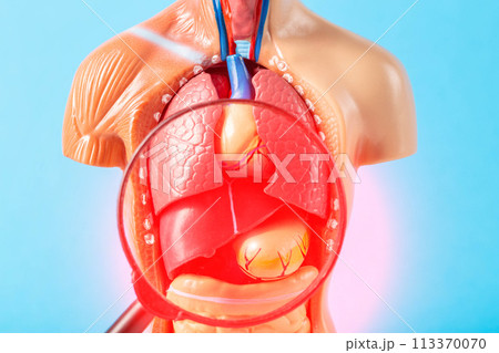 Inflamed internal organs of a human medical mockup under a magnifying glass on a blue background. Liver cirrhosis, pancreatitis and splenomegaly, close-up 113370070
