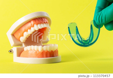 Dental mouthguard and cofferdam in the hand of a dentist doctor against the background of a mock-up of a dental jaw on a yellow background. Concept for the treatment of bruxism, teeth grinding during 113370457