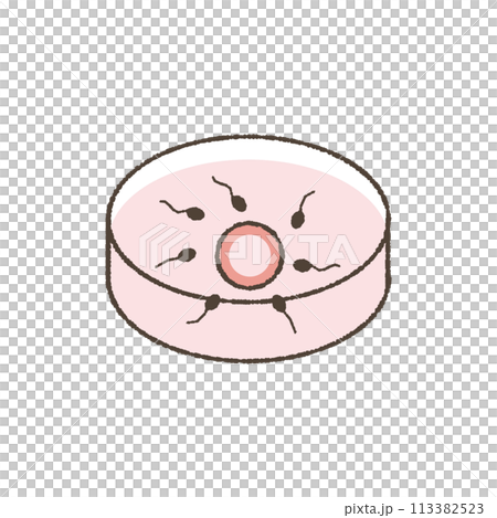 人工授精、体外受精のイラスト。 人工授精、体外受精のイラスト。 113382523