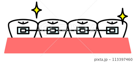 歯並びを美しく揃える歯の矯正イラスト 113397460