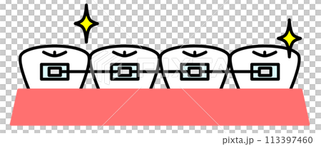 歯並びを美しく揃える歯の矯正イラスト 113397460