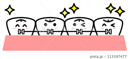 歯並びを美しく揃える歯の矯正イラスト 113397477