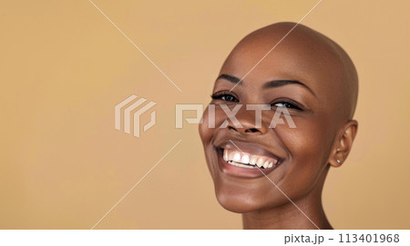 women with shaved heads 113401968