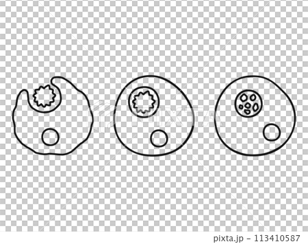 食作用・線画 113410587