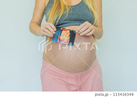 Joyful pregnant woman shares the exciting news, proudly displaying her positive pregnancy test and a heartwarming ultrasound photo Joyful pregnant woman shares the exciting news, proudly displaying her positive pregnancy test and a heartwarming ultrasound photo 113416349