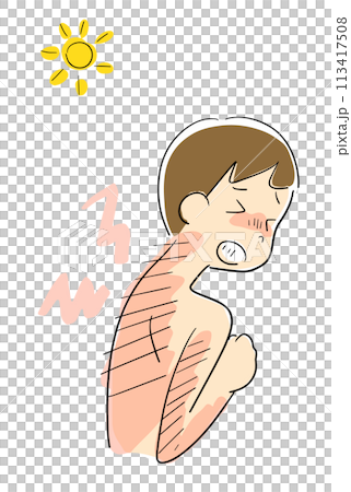 日焼けした背中が痛い男性 日焼けした背中が痛い男性 113417508