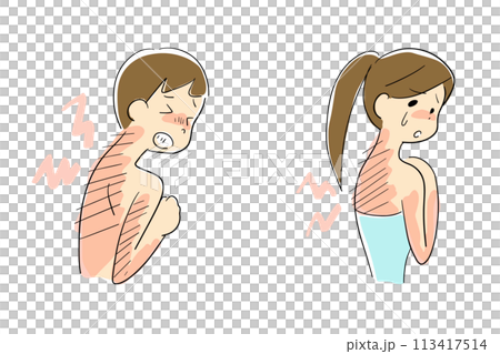 Men and women with sunburned back pain Men and women with sunburned back pain 113417514