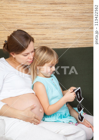 Little girl amazed by ultrasound images of her unborn sibling 113422562