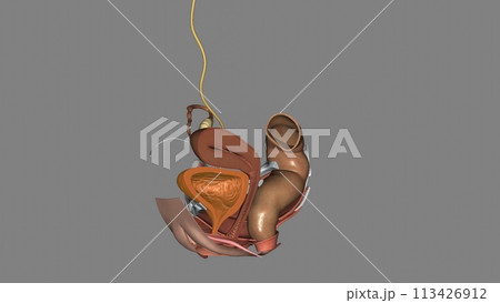 The urinary bladder is a temporary storage reservoir for urine. It is located in the pelvic cavity The urinary bladder is a temporary storage reservoir for urine. It is located in the pelvic cavity 113426912