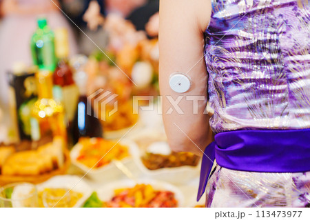 Sugar monitoring sensor on the shoulder. An insulin pump. Sugar monitoring sensor on the shoulder. An insulin pump. 113473977