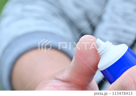手荒れ　男性　指　手　ハンドクリーム 113478413