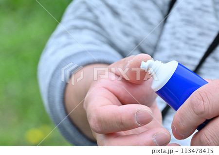 手荒れ　男性　指　手　ハンドクリーム 113478415