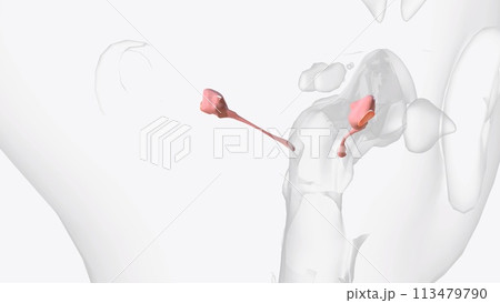 The thin semitransparent tympanic membrane, or eardrum, which forms the boundary between the outer ear and the middle ear The thin semitransparent tympanic membrane, or eardrum, which forms the boundary between the outer ear and the middle ear 113479790