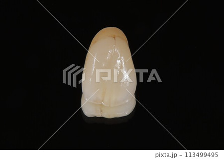 オールセラミッククラウン 113499495